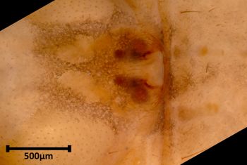 Media type: image;   Invertebrate Zoology 20592 Aspect: ventral epigynum